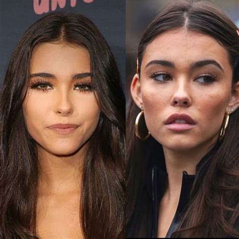 madison beer before plastic|Madison Beer Before And After Lip Fillers —Yay Or。